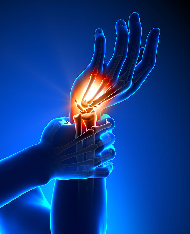 A Hand With The Words Pain Of The Hand On It And An Image Of A Medical A Hand With The Words Pain Of The Hand On It And An Image Of A Medical