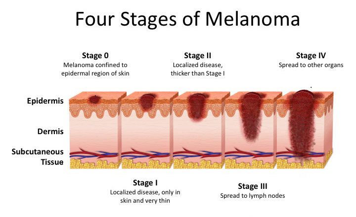 Beyond The Clinic Podcast Aim At Melanoma Foundation Beyond The Clinic Podcast Aim At Melanoma Foundation