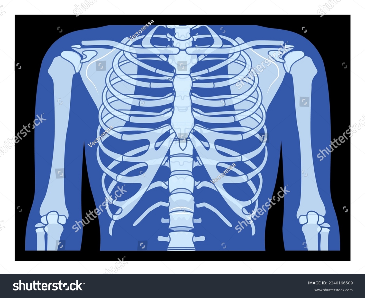 Exo Rib Cage: Innovative Design for Enhanced Protection