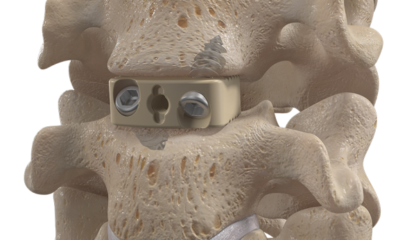 Fellowship Trained Orthopedic Spine Surgeon Dr Mark Mcfarland Fellowship Trained Orthopedic Spine Surgeon Dr Mark Mcfarland