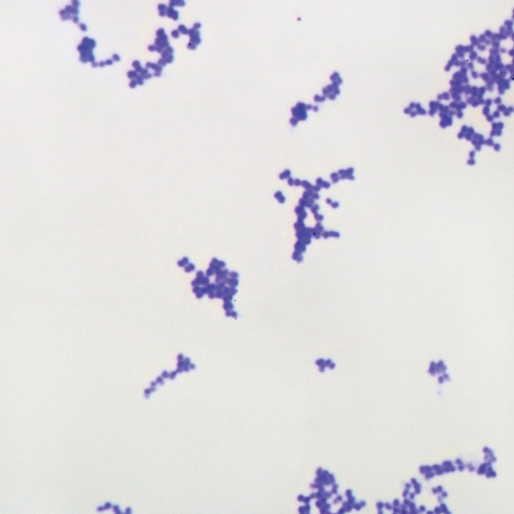 Gram Positive Cocci in Clusters: Key Facts & Insights
