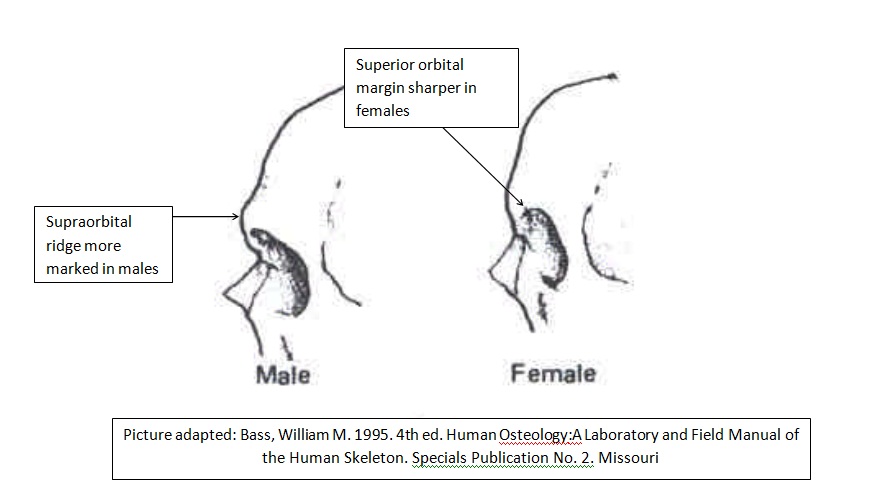 Male vs Female Skull: Key Differences Explained