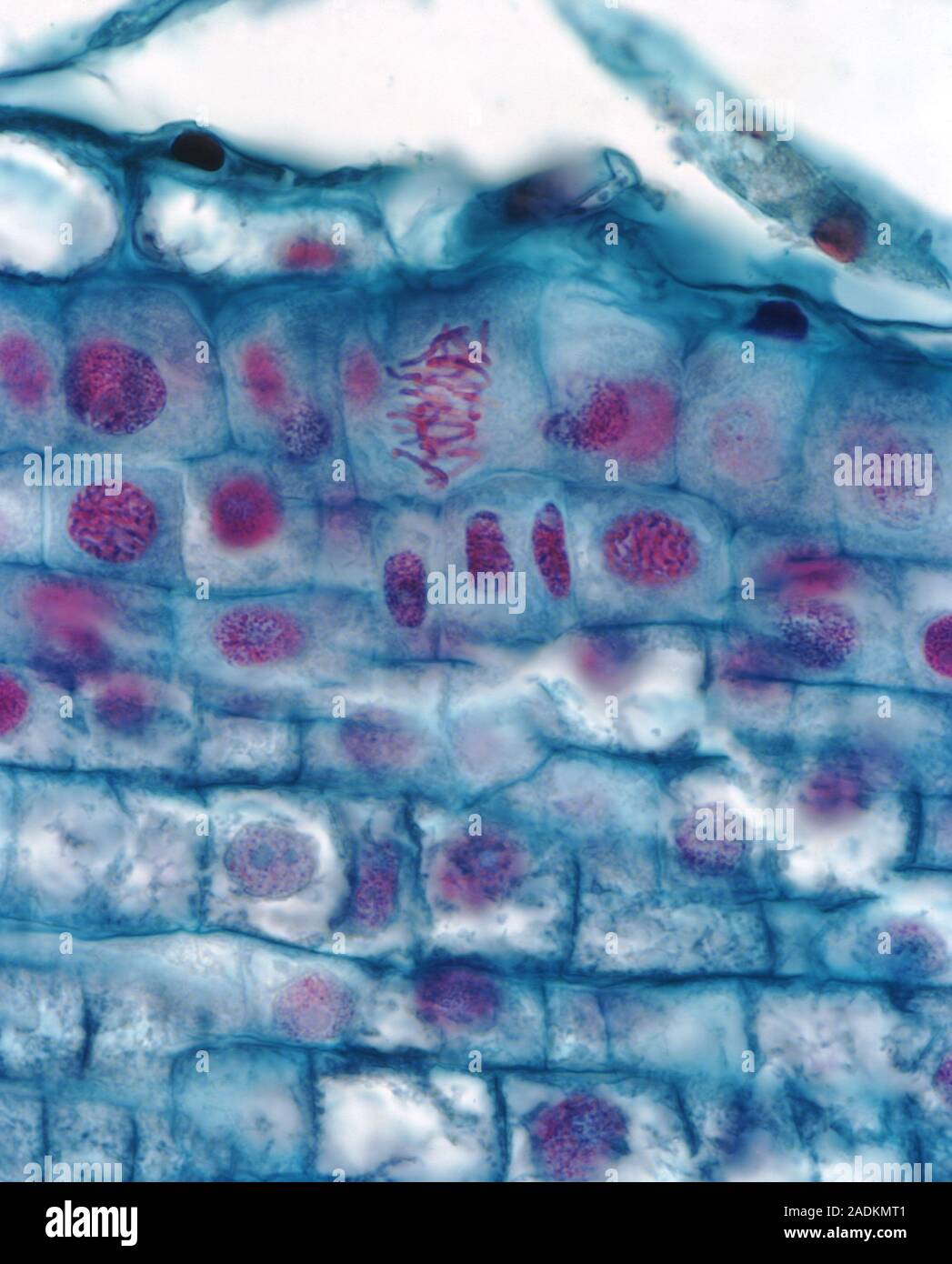 Mitosis Light Micrograph Of Onion Allium Cepa Root Tip Cells Mitosis Light Micrograph Of Onion Allium Cepa Root Tip Cells