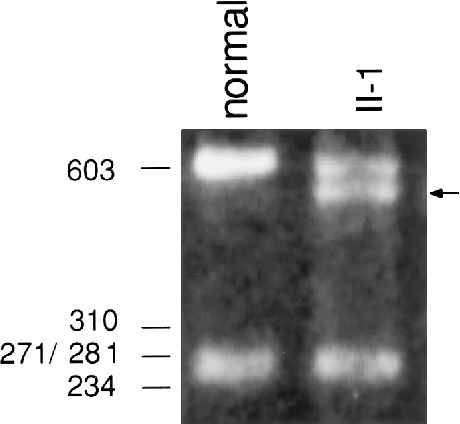 Pathway Analysis A D Impact Of Col11a1 And Associated Gene In Pathway Analysis A D Impact Of Col11a1 And Associated Gene In