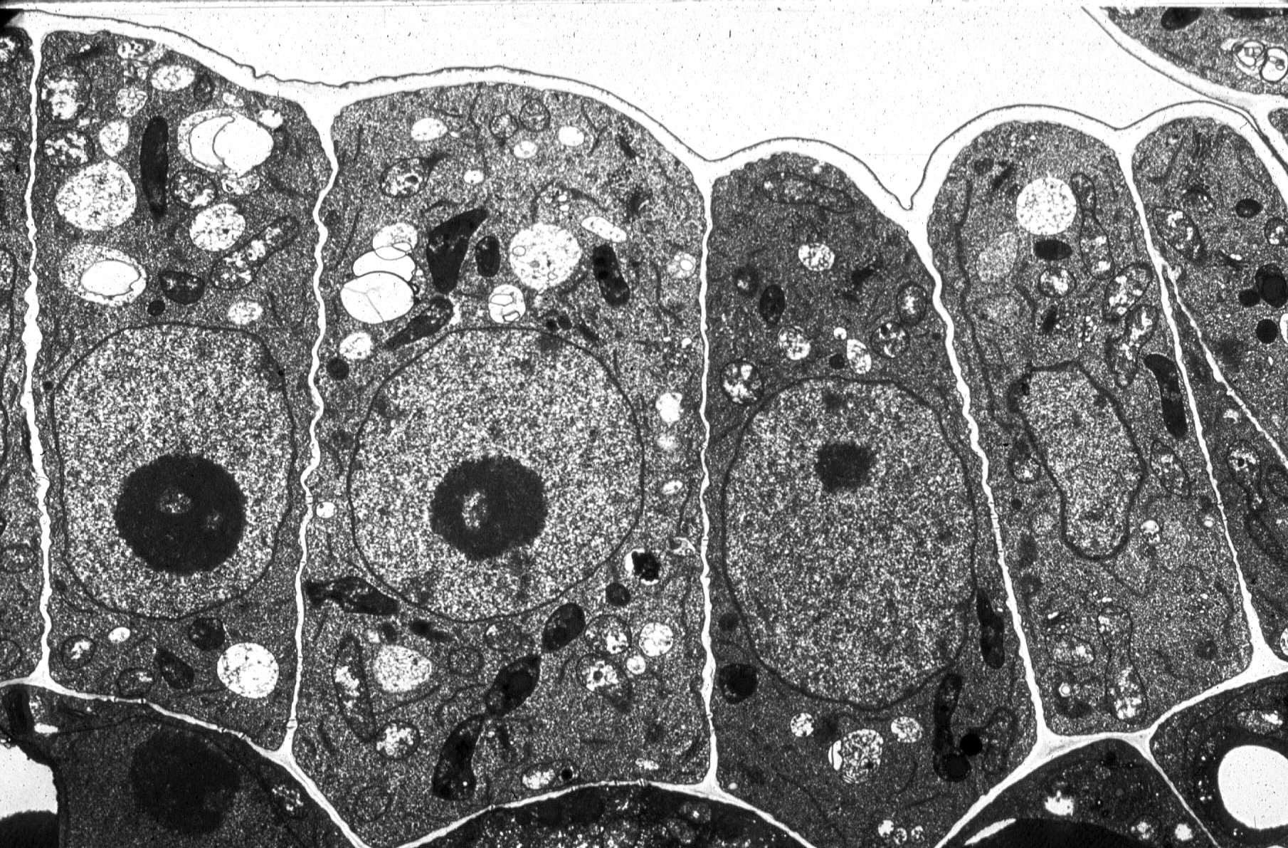 Plant Cells Under An Electron Microscope Plant Cells Under An Electron Microscope