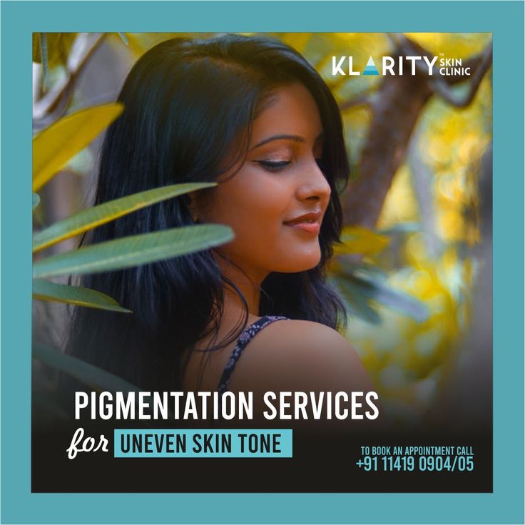 Understanding Skin Pigmentation Causes And Solutions By Understanding Skin Pigmentation Causes And Solutions By